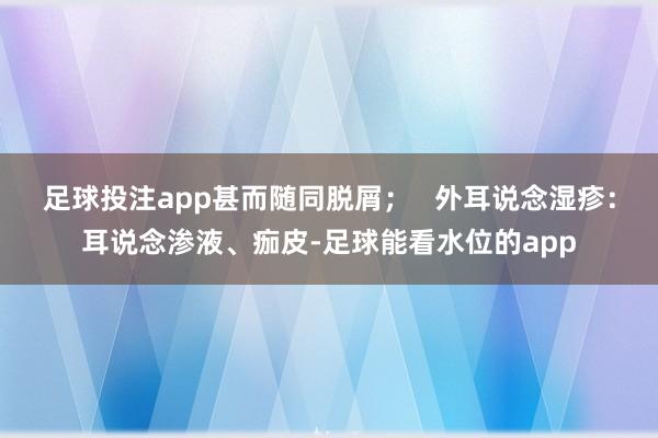 足球投注app甚而随同脱屑；   外耳说念湿疹：耳说念渗液、痂皮-足球能看水位的app